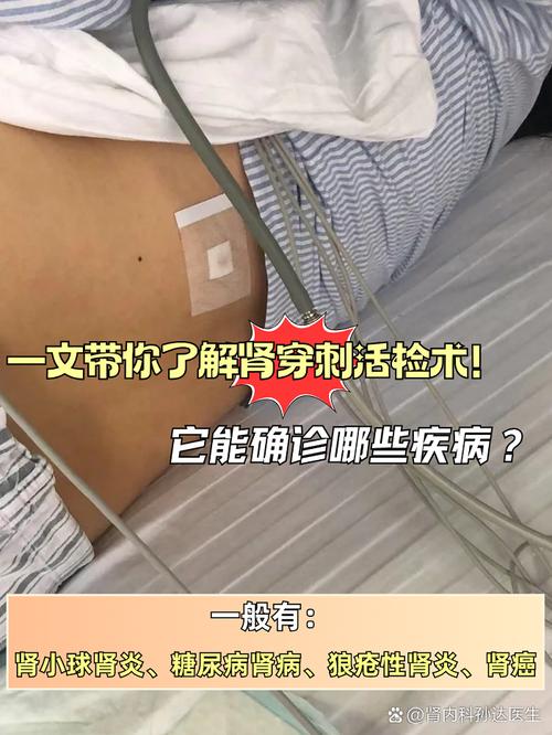蒋圣龙退役传闻被击破 已完成肾脏穿刺引流手术